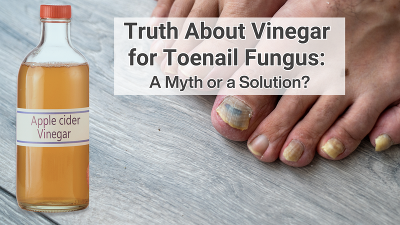 Truth About Vinegar for Toenail Fungus: A Myth or a Solution?