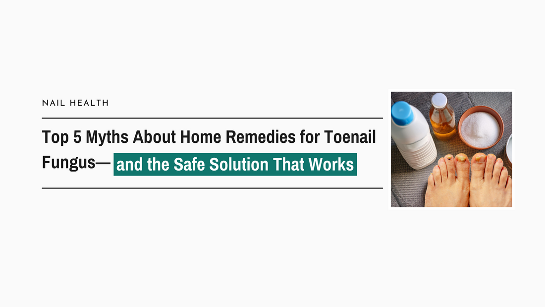 Top 5 Myths About Home Remedies for Toenail Fungus—and the Safe Solution That Works