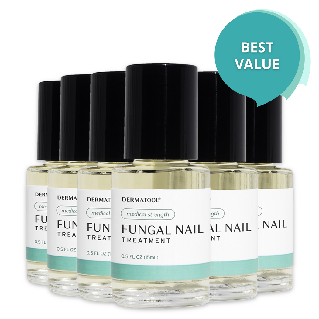 Nail Fungus Treatment - Medical Strength
