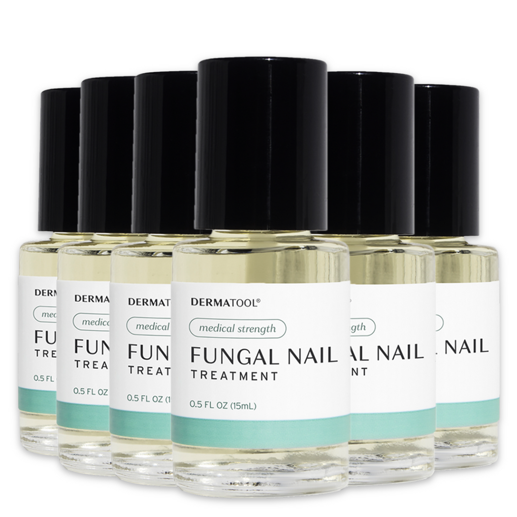 Nail Fungus Treatment - Medical Strength