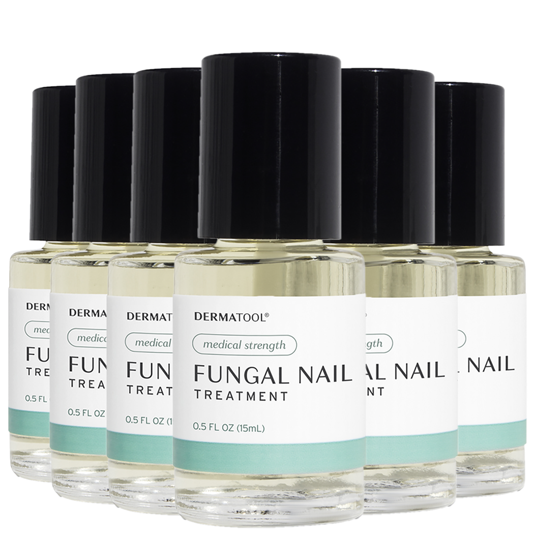 Nail Fungus Treatment - Medical Strength